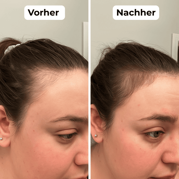 Geliebt von über 80.000+ Kundinnen